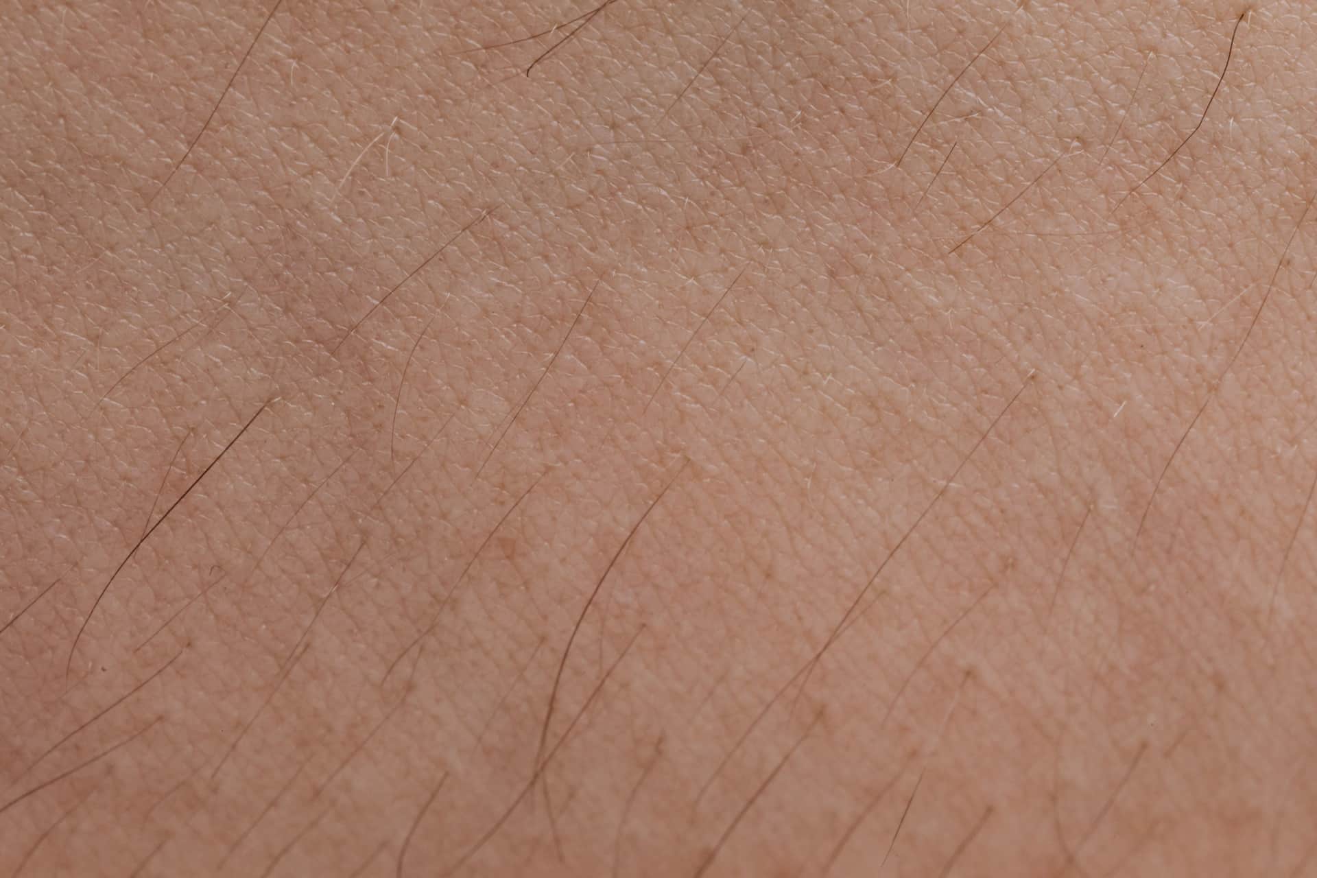 A close, soft-focus study of natural skin texture in warm light